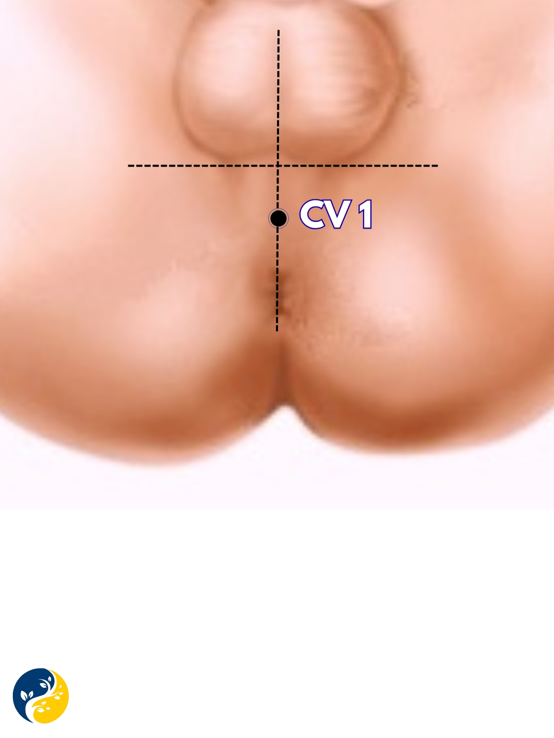 CV1 acupuncture point