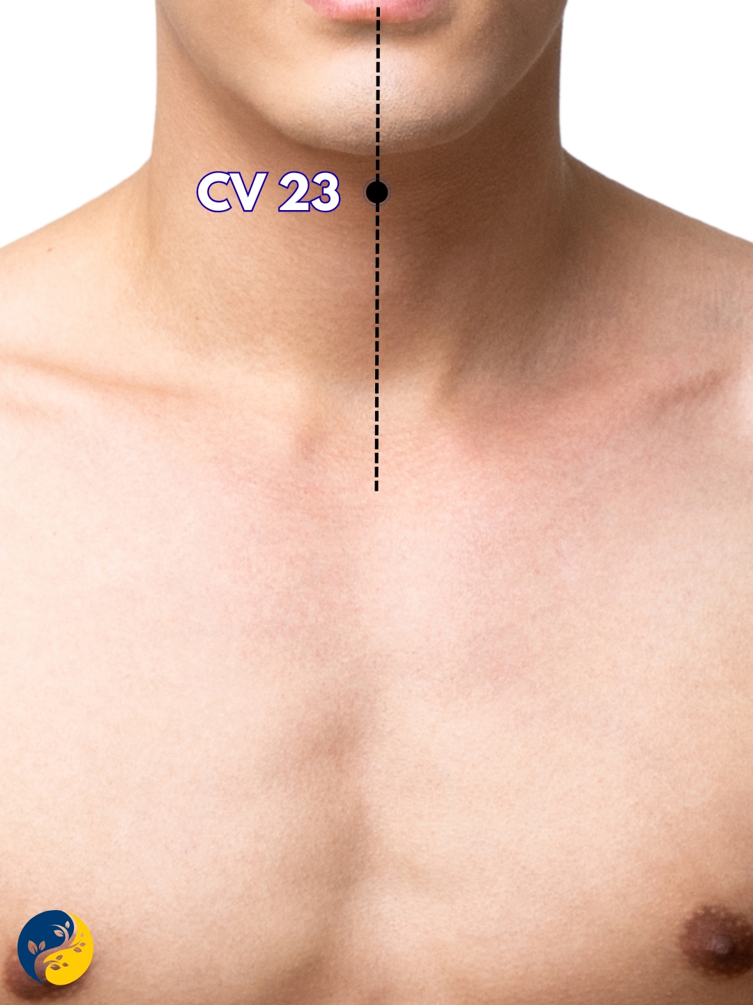 CV23