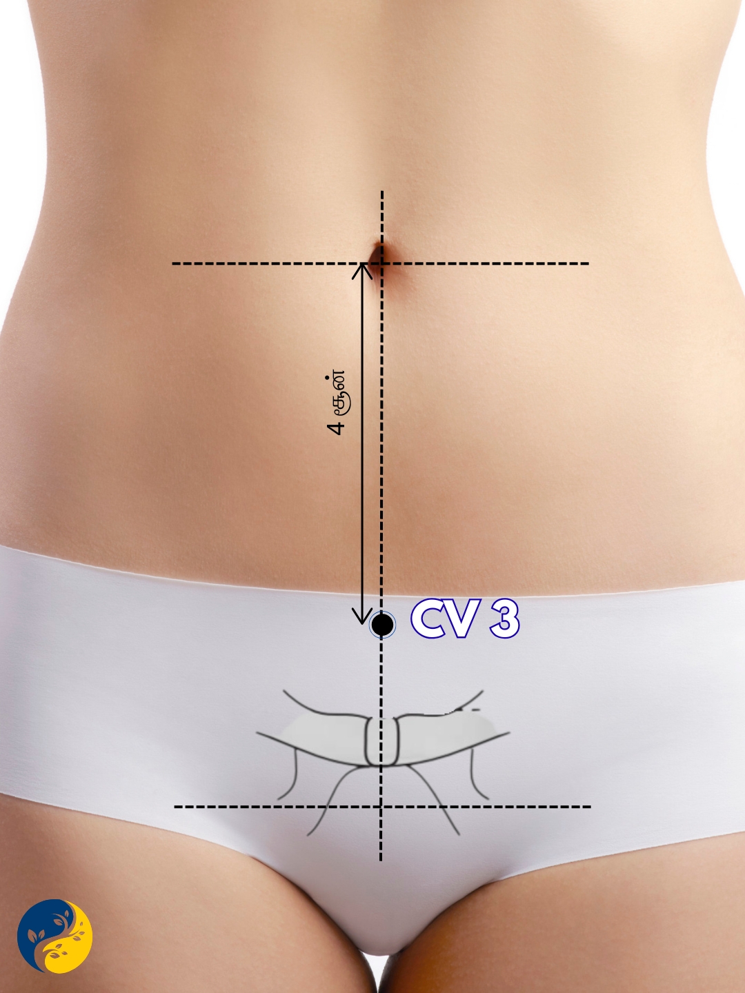 CV3