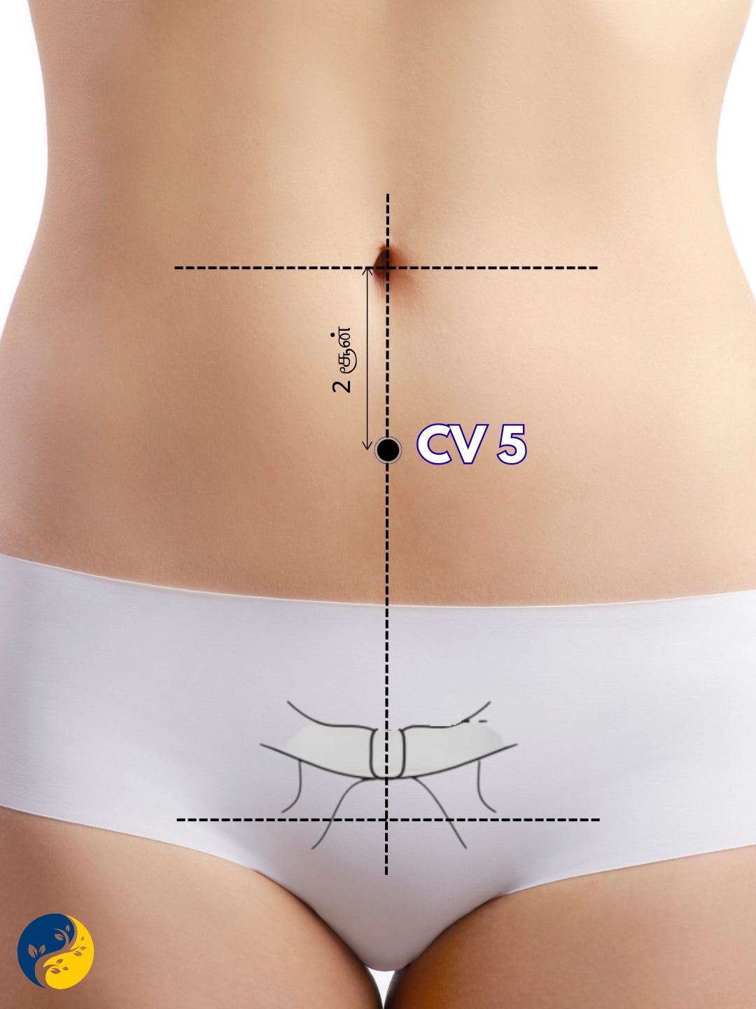 CV5