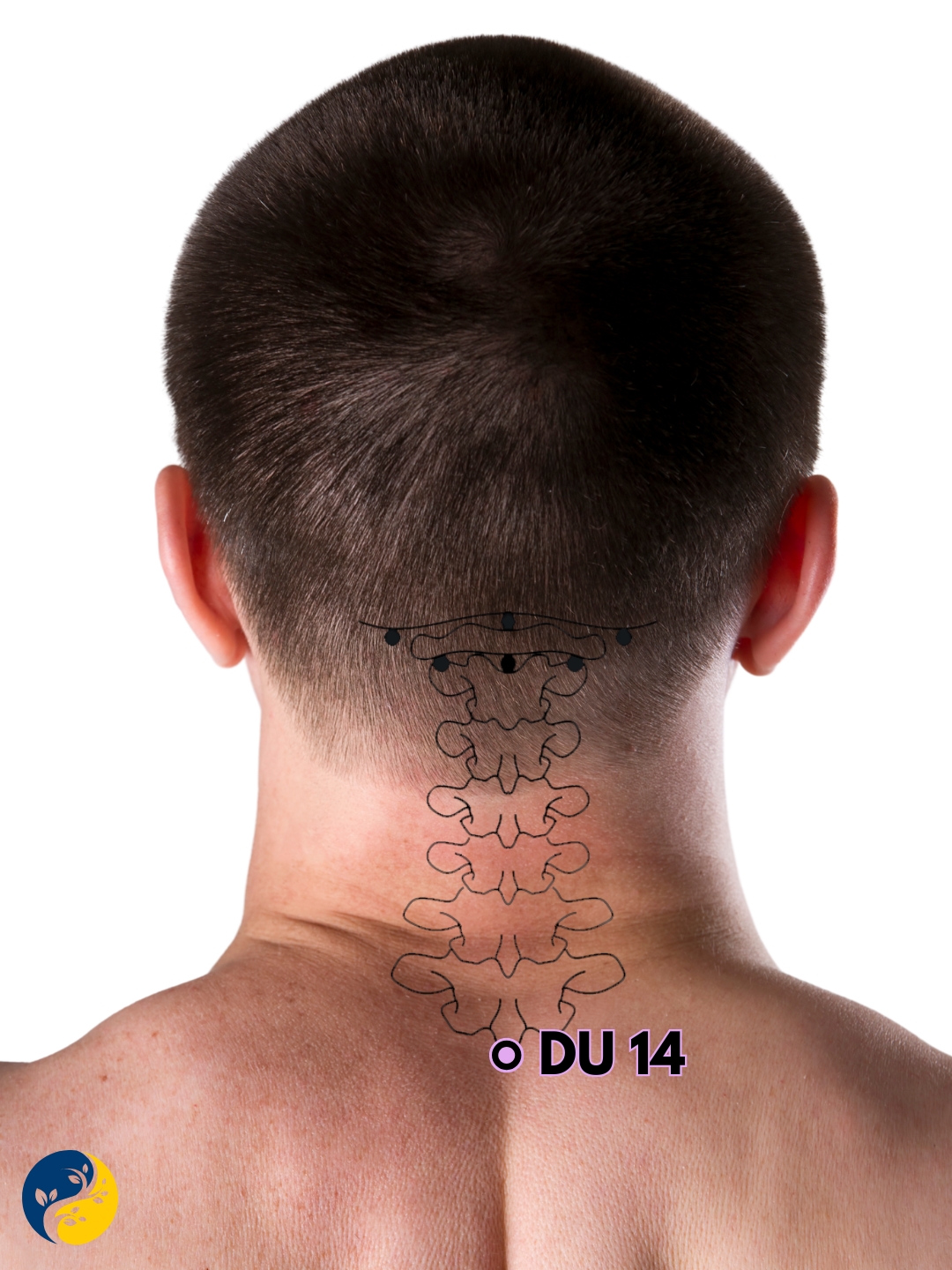 DU14 acupuncture point