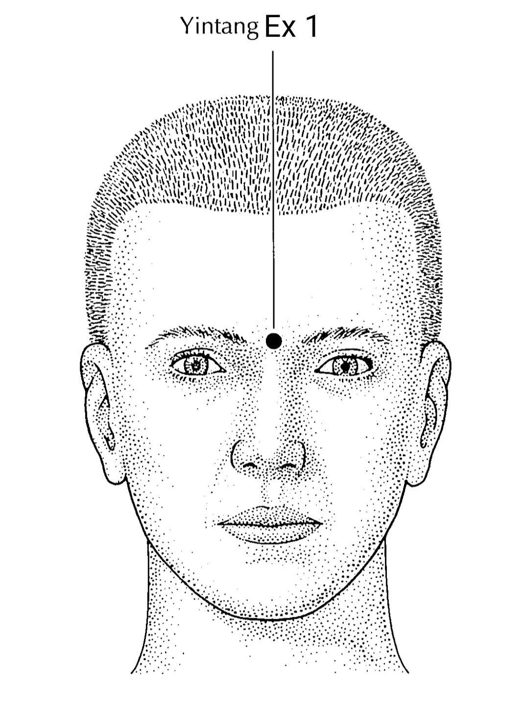 EX1 acupuncture point