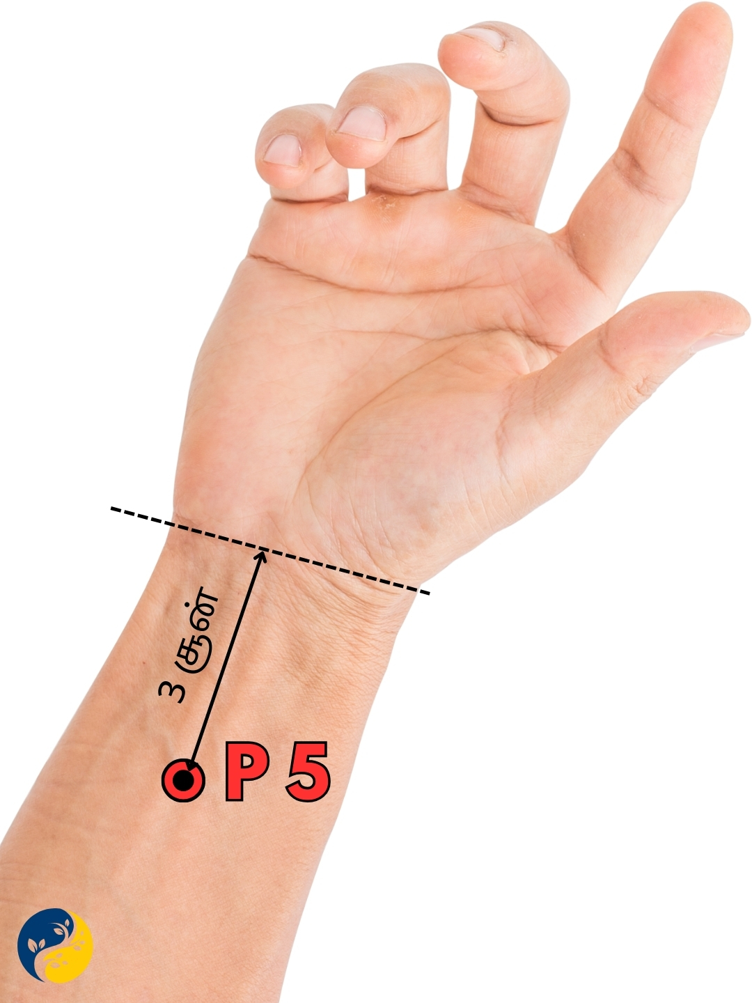 P5 acupuncture point