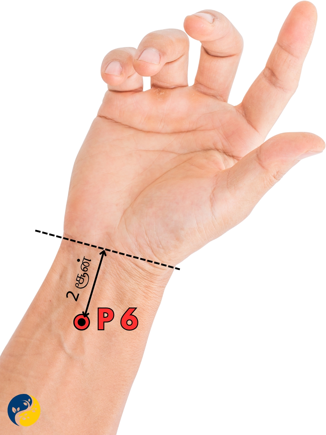 P6 acupuncture point
