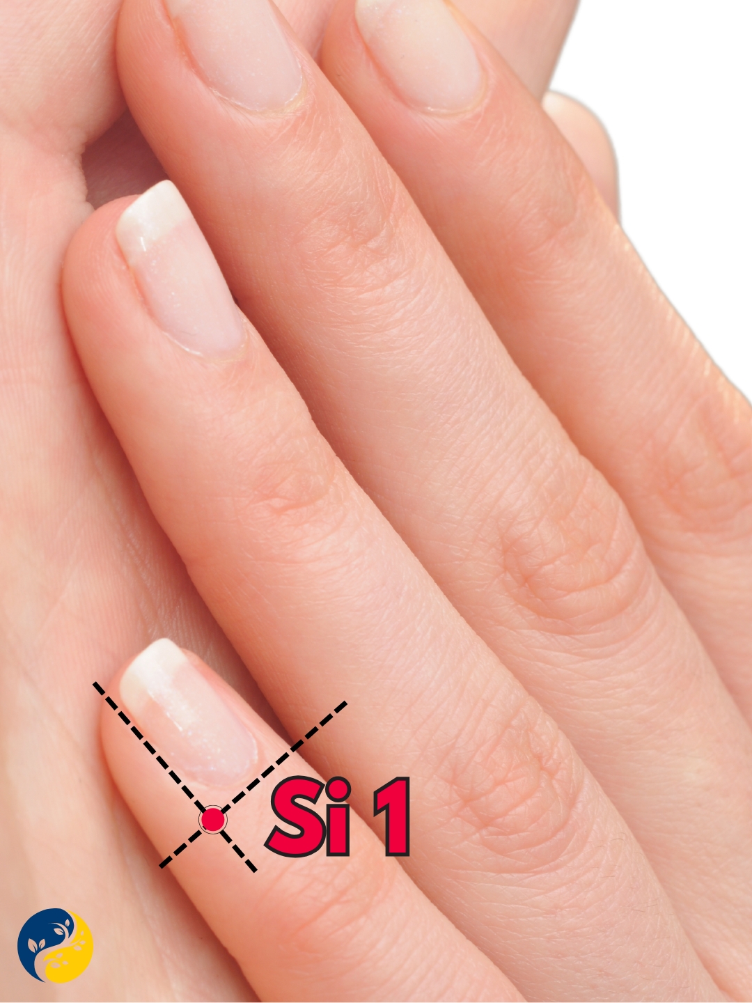 SI1 acupuncture point