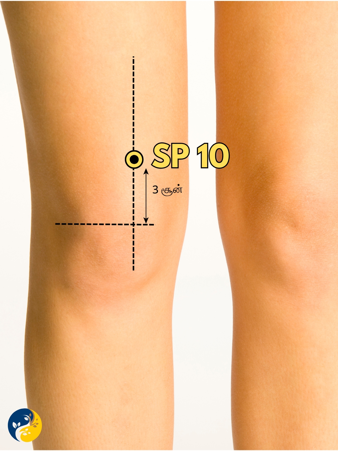 SP10