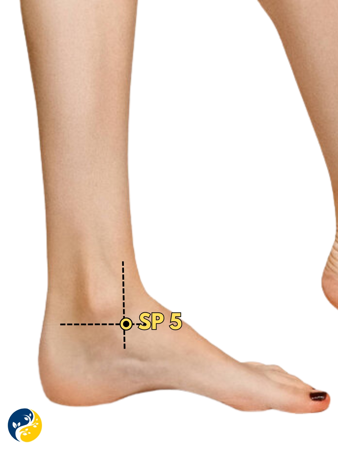 SP5 acupuncture point