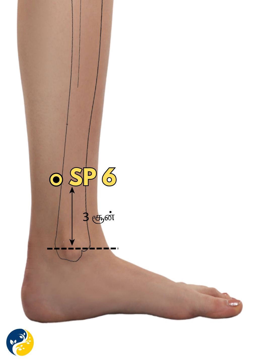 SP6 acupuncture point