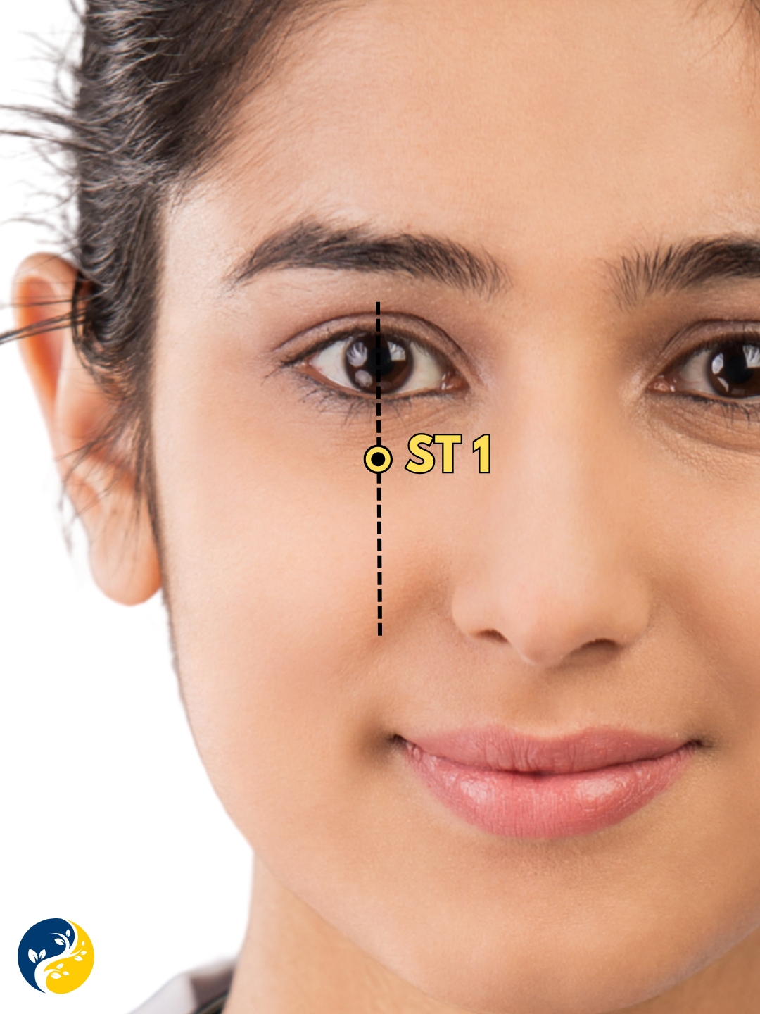 ST1 acupuncture point