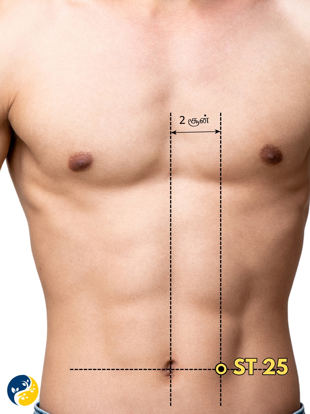 ST25 acupuncture point