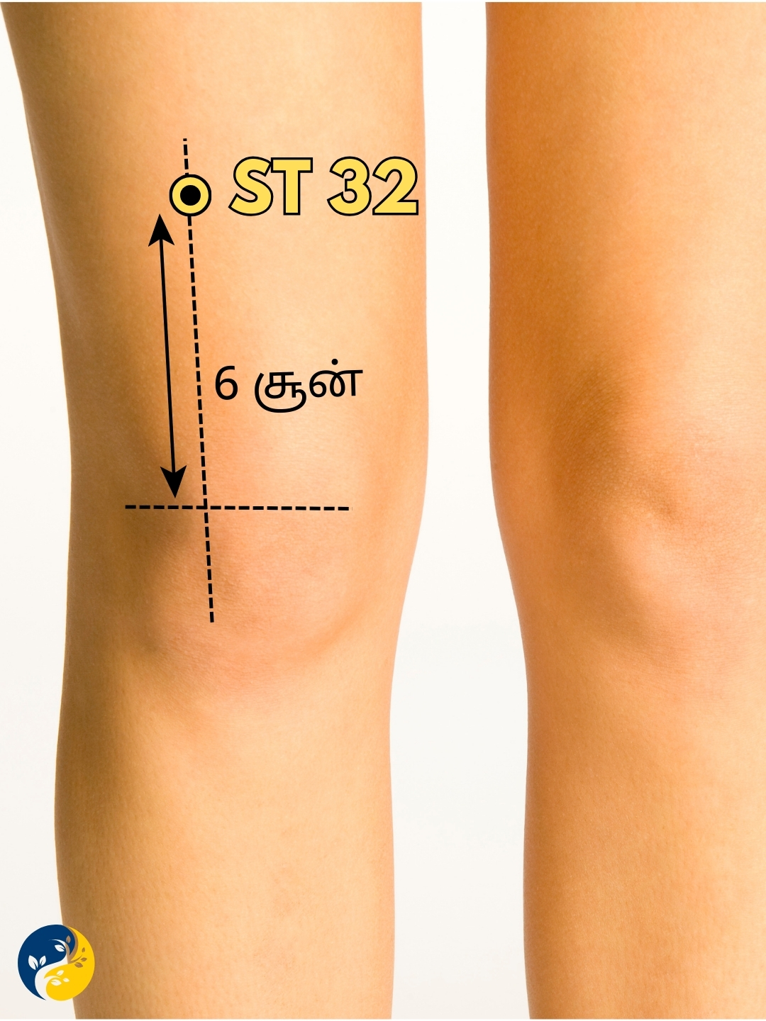 ST32 acupuncture point