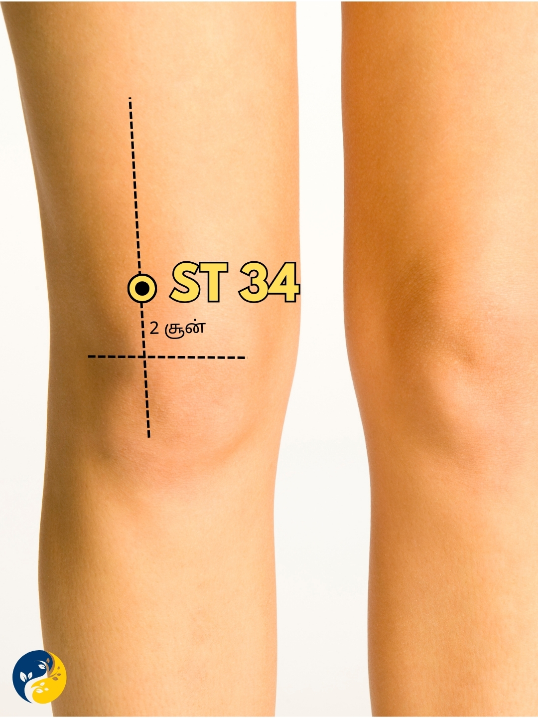ST34 acupuncture point