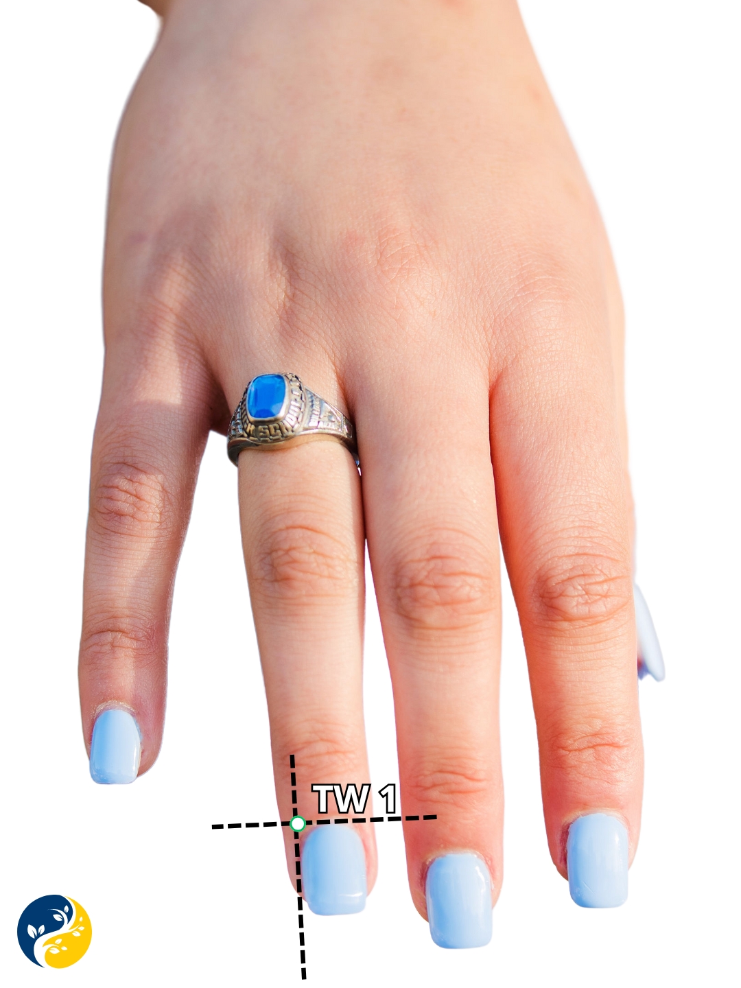 TW1 acupuncture point