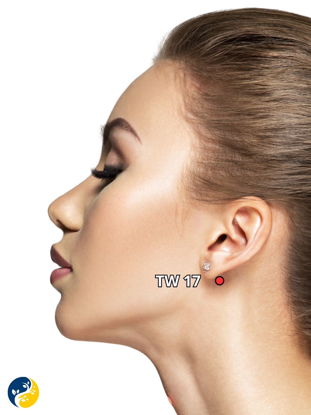 TW17