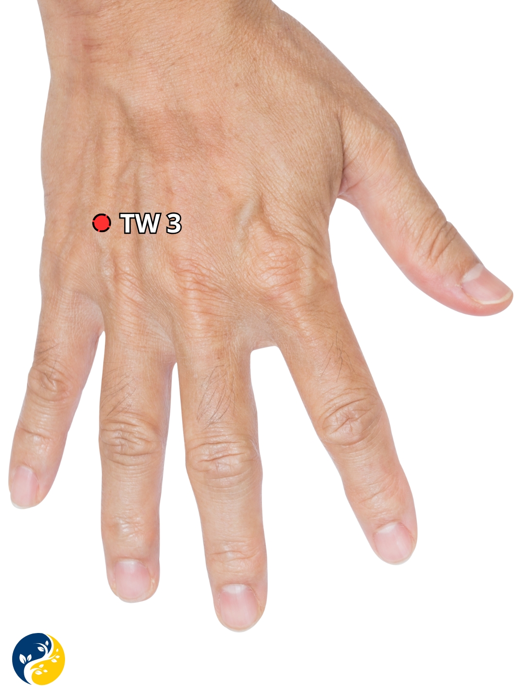TW3 acupuncture point