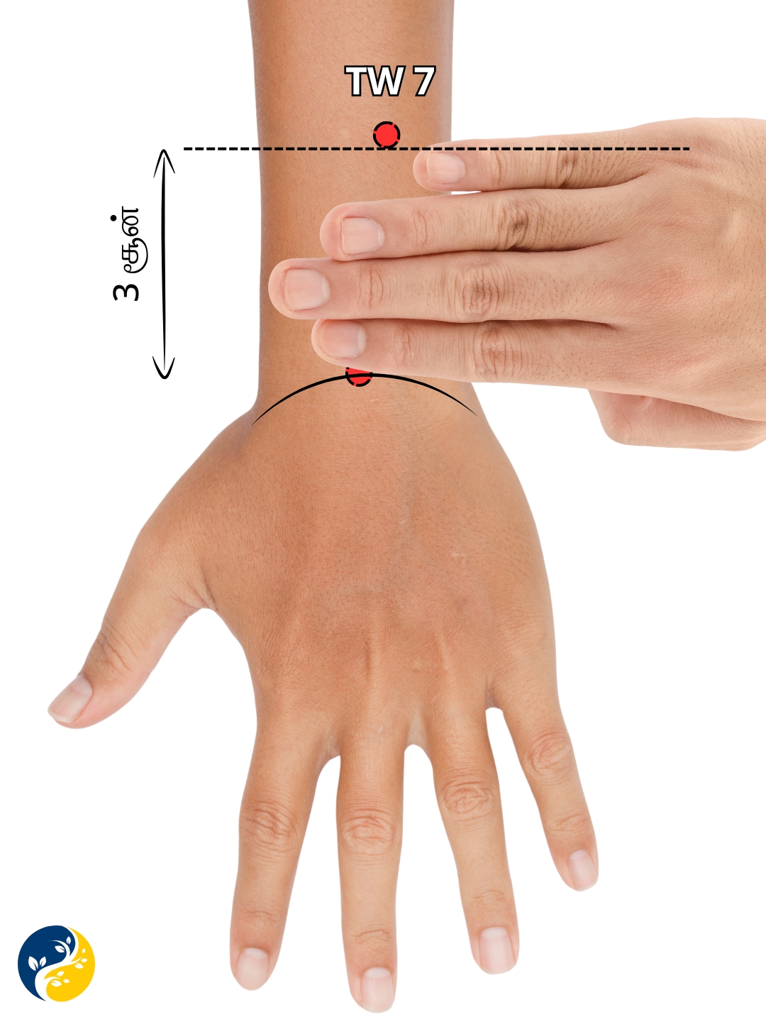 TW7 acupuncture point