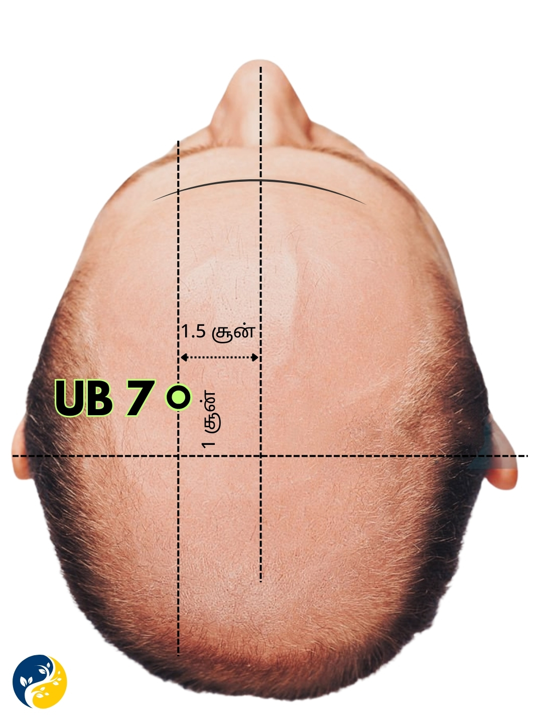 UB7 acupuncture point