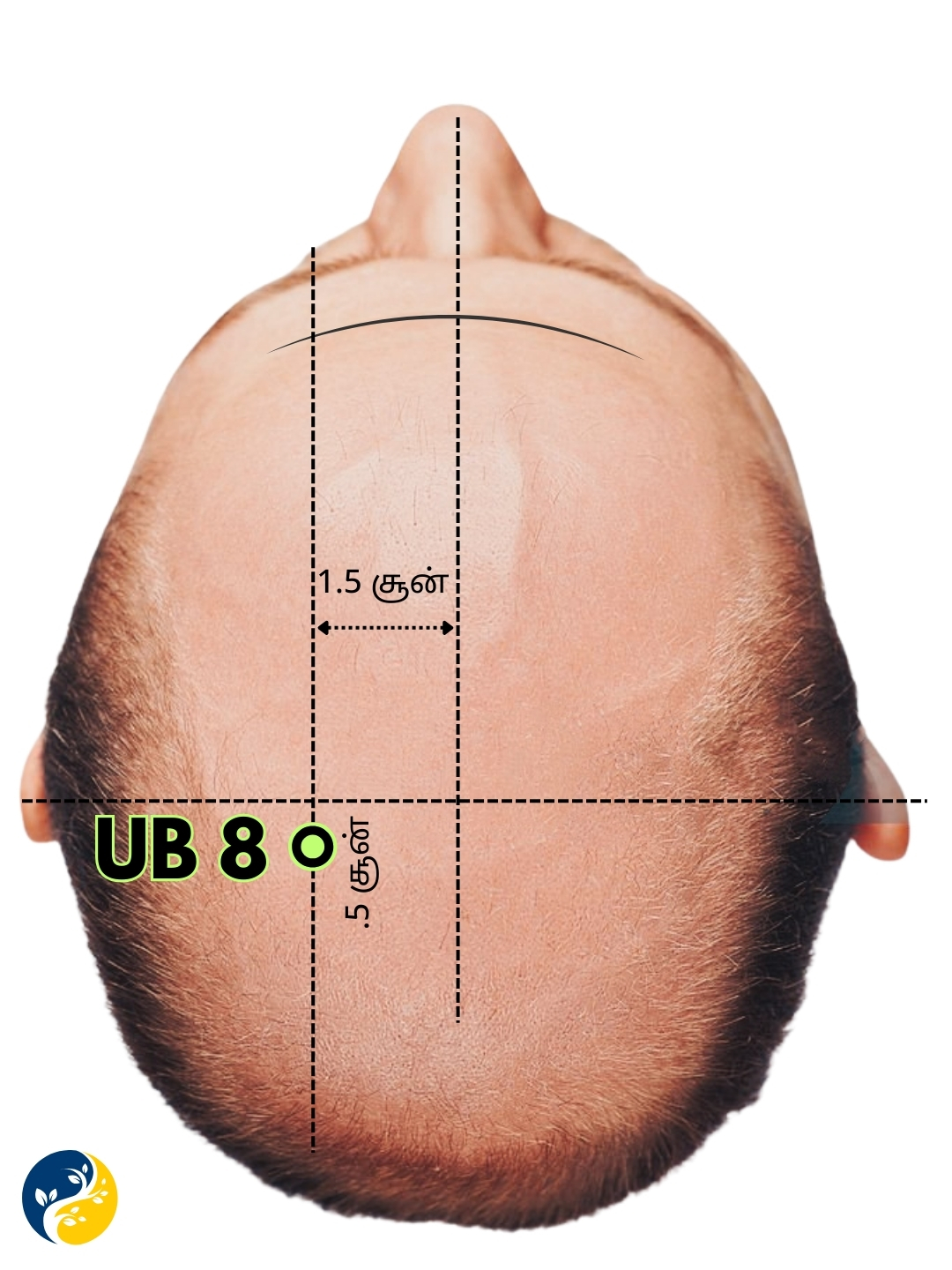 UB8 acupuncture point